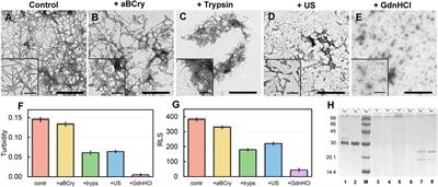 Amyloid fibrils degradation: the pathway to recovery or aggravation of the disease?